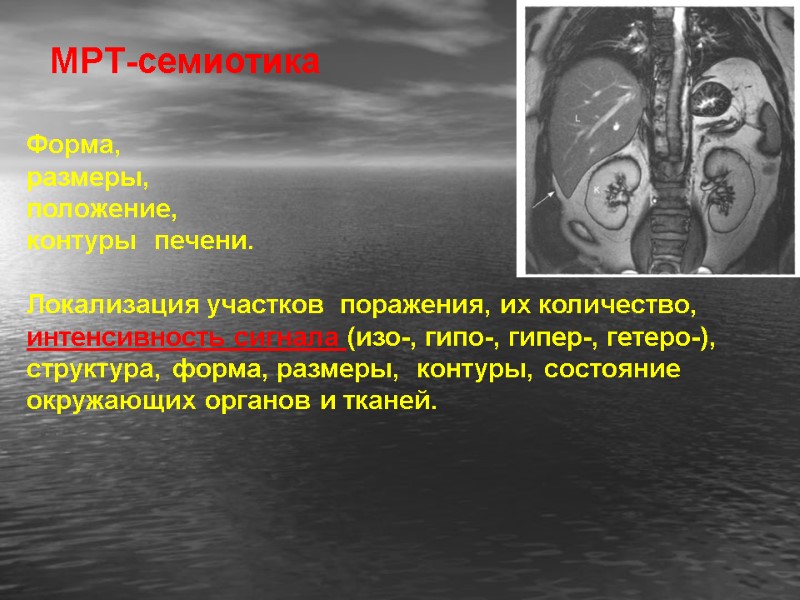 МРТ-семиотика  Форма,  размеры,  положение,  контуры  печени.   Локализация